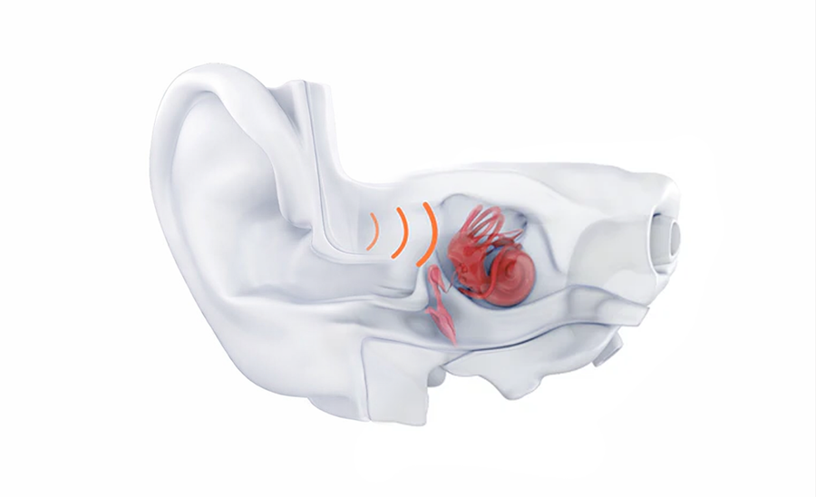 How Bone Conduction Creates Personalized Sleep Therapy 