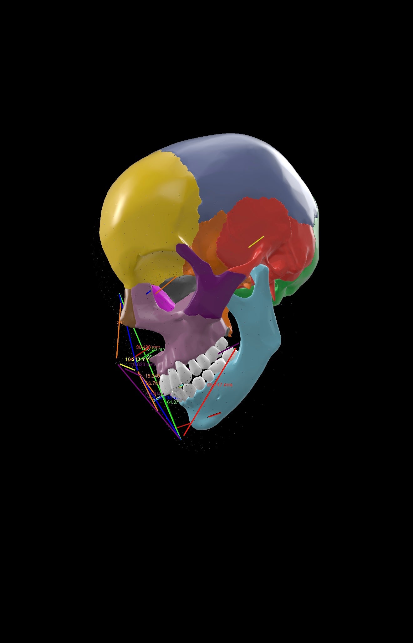 AI Enabled Phenotyping