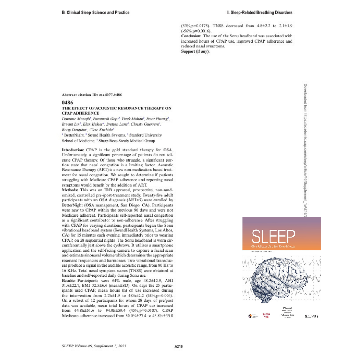 The Effect of Acoustic Resonance Therapy on CPAP Adherence